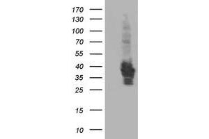 Western Blotting (WB) image for anti-HSPA Binding Protein, Cytoplasmic Cochaperone 1 (HSPBP1) antibody (ABIN1498757) (HSPBP1 抗体)