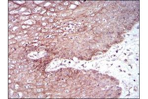 Immunohistochemistry (IHC) image for anti-Desmoglein 3 (DSG3) (AA 55-159) antibody (ABIN2682987)