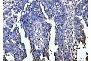 IHC analysis of Giantin/GOLGB1 using anti-Giantin/GOLGB1 antibody (ABIN7600139).