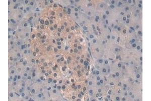 Immunohistochemistry (IHC) image for anti-Proteasome (Prosome, Macropain) Subunit, beta Type, 6 (PSMB6) (AA 2-239) antibody (ABIN7436234)