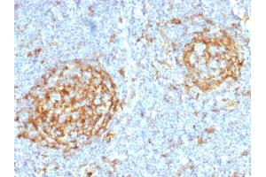 Formalin-fixed, paraffin-embedded human Lymph Node stained with CD14 Mouse Monoclonal Antibody (LPSR/2397). (CD14 抗体  (AA 25-148))