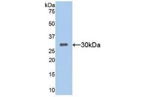 Detection of Recombinant SIRT1, Mouse using Polyclonal Antibody to Sirtuin 1 (SIRT1) (SIRT1 抗体  (AA 236-490))