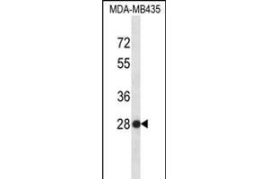 SNRPB2 Antibody (N-term) (ABIN656315 and ABIN2845618) western blot analysis in MDA-M cell line lysates (35 μg/lane). (SNRPB2 抗体  (N-Term))