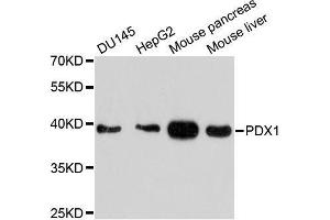 Western blot analysis of extracts of various cell lines, using PDX1 antibody. (PDX1 抗体  (AA 1-100))