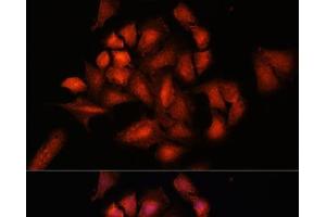 Immunofluorescence (IF) image for anti-Signal Transducing Adaptor Molecule (SH3 Domain and ITAM Motif) 2 (STAM2) antibody (ABIN7263017)