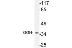 Western blot (WB) analysis of GGH antibody in extracts from RAW264. (GGH 抗体)