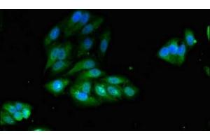Immunofluorescent analysis of Hela cells using ABIN7156336 at dilution of 1:100 and Alexa Fluor 488-congugated AffiniPure Goat Anti-Rabbit IgG(H+L) (IRS2 抗体  (AA 766-1001))