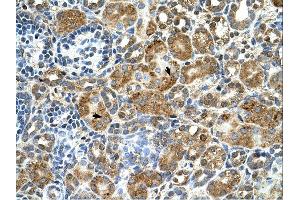 Cystatin B antibody was used for immunohistochemistry at a concentration of 4-8 ug/ml. (CSTB 抗体)