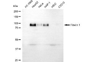 Western blotting analysis using fibulin 1 antibody (ABIN7798616).