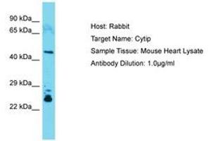 Image no. 1 for anti-Cytohesin 1 Interacting Protein (CYTIP) (C-Term) antibody (ABIN6749905) (CYTIP 抗体  (C-Term))