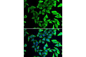 Immunofluorescence analysis of U2OS cells using VSNL1 antibody (ABIN1875337). (VSNL1 抗体)