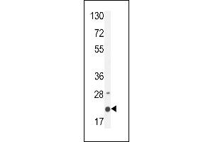 M4A4A Antibody (N-term) (ABIN654770 and ABIN2844450) western blot analysis in MDA-M cell line lysates (35 μg/lane).