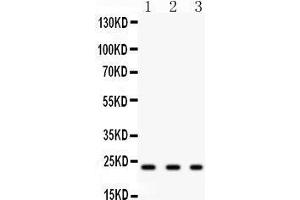 Anti-GST3/GST pi antibody,Western blotting All lanes: Anti GST3/GST pi  at 0. (GSTP1 抗体  (N-Term))