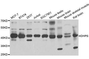 Western blot analysis of extracts of various cell lines, using DHPS antibody.
