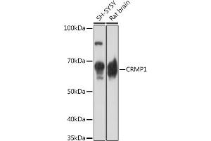 Western blot analysis of extracts of various cell lines, using CRMP1 Rabbit mAb (ABIN7266468) at 1:1000 dilution. (CRMP1 抗体)