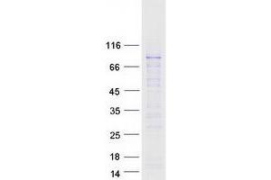 Western Blotting (WB) image for Ring Finger Protein 168 (RNF168) protein (Myc-DYKDDDDK Tag) (ABIN2731039)
