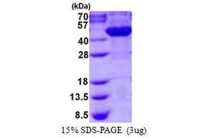 Arsenic (+3 Oxidation State) Methyltransferase (AS3MT) protein (His tag)