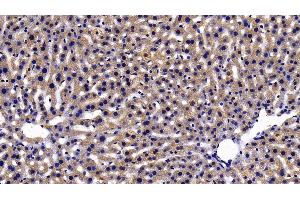 Immunohistochemistry (IHC) image for anti-Peroxiredoxin 2 (PRDX2) (AA 6-164) antibody (ABIN7437812)