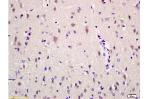 Immunohistochemistry (IHC) image for anti-Ribonuclease/angiogenin Inhibitor 1 (RNH1) (AA 101-200) antibody (ABIN872914)