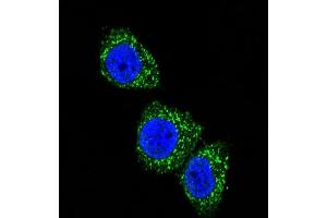 Confocal immunofluorescent analysis of MEN1 Antibody  (ABIN391614 and ABIN2841535) with Hela cell followed by Alexa Fluor 488-conjugated goat anti-rabbit lgG (green). (Menin 抗体  (AA 584-615))