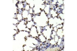 Immunohistochemistry of paraffin-embedded mouse lung using CBX5 antibody. (CBX5 抗体  (AA 1-100))