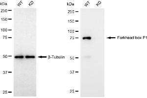 anti-Forkhead Box P1 (FOXP1) antibody