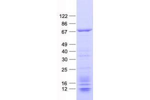 Validation with Western Blot (CDY2A Protein (His tag))