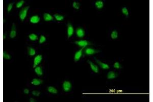 Image no. 4 for anti-Apoptosis Inhibitor 5 (API5) (AA 400-504) antibody (ABIN466131) (Apoptosis Inhibitor 5 抗体  (AA 400-504))