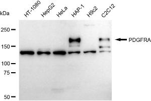 Western blotting analysis using PDGFRA antibody (ABIN7799847).