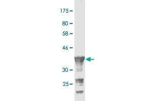 Western Blot detection against Immunogen (36. (PCDH20 抗体  (AA 395-494))