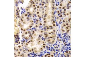 Immunohistochemistry of paraffin-embedded Human gastric using XRCC5 antibody at dilution of 1:100 (40x lens). (XRCC5 抗体)