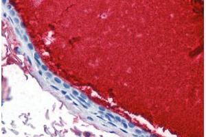 Human Breast, Ductal with Secretion (formalin-fixed, paraffin-embedded) stained with LTF antibody ABIN337355 at 10 ug/ml followed by biotinylated anti-mouse IgG secondary antibody ABIN481714, alkaline phosphatase-streptavidin and chromogen. (Lactoferrin 抗体)