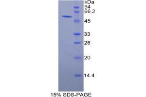 SDS-PAGE analysis of Rat Granzyme M Protein. (GZMM 蛋白)