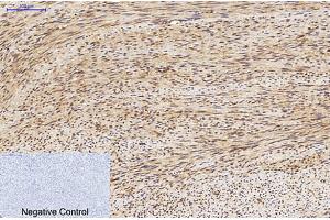 Immunohistochemical analysis of paraffin-embedded human uterus tissue.