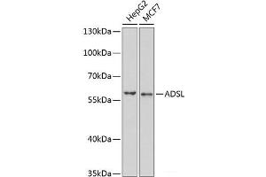 Western blot analysis of extracts of various cell lines using ADSL Polyclonal Antibody at dilution of 1:1000. (Adenylosuccinate Lyase 抗体)