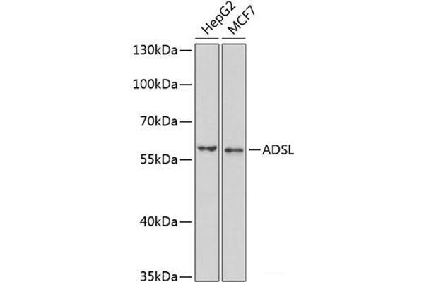 Adenylosuccinate Lyase anticorps