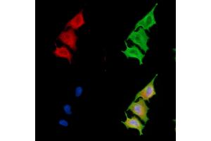 ABIN6264298 and ABIN6279665 staining  cells by IF/ICC.