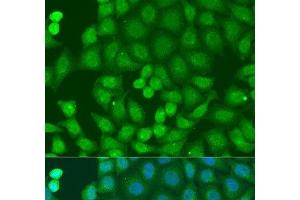 Immunofluorescence analysis of U2OS cells using ZFYVE16 Polyclonal Antibody at dilution of 1:100. (ZFYVE16 抗体)