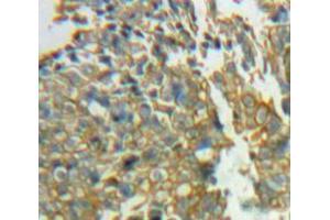 Used in DAB staining on fromalin fixed paraffin-embedded Ovary tissue (SIRPG 抗体  (AA 111-372))