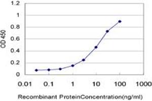Detection limit for recombinant GST tagged KIAA0261 is approximately 0. (WAPAL 抗体  (AA 1-402))