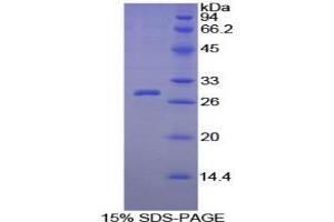 SDS-PAGE analysis of Guinea Pig C-Reactive Protein. (CRP 蛋白)