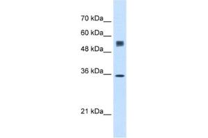 Western Blotting (WB) image for anti-Signal Sequence Receptor, alpha (SSR1) antibody (ABIN2462851) (SSR1 抗体)