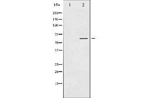 Western blot analysis of Tyrosine Hydroxylase phosphorylation expression in RAW264. (Tyrosine Hydroxylase 抗体  (pSer40))