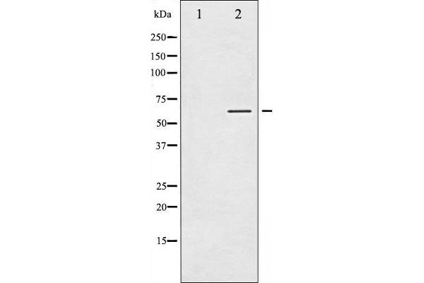 Tyrosine Hydroxylase 抗体  (pSer40)