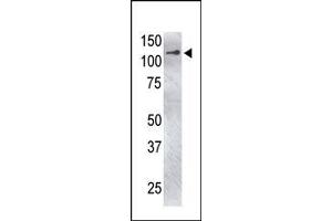 Image no. 1 for anti-Ubiquitin Specific Peptidase 4 (USP4) (C-Term) antibody (ABIN357526) (USP4 抗体  (C-Term))