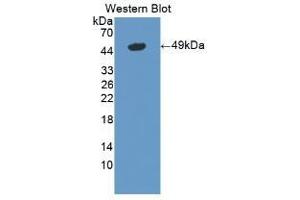 Detection of Recombinant LSR, Mouse using Polyclonal Antibody to Lipolysis Stimulated Lipoprotein Receptor (LSR) (LSR 抗体  (AA 35-205))