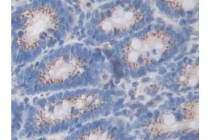Detection of SDF4 in Rat Colon Tissue using Polyclonal Antibody to Stromal Cell Derived Factor 4 (SDF4) (SDF4 抗体  (AA 184-382))