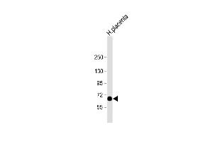 Anti-STT3A Antibody (Center) at 1:2000 dilution + human placenta lysate Lysates/proteins at 20 μg per lane. (STT3A 抗体  (AA 476-507))