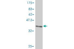 Western Blot detection against Immunogen (37. (DBC1 抗体  (AA 662-761))