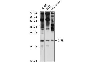 Western blot analysis of extracts of various cell lines, using CSF3 antibody (ABIN6127710, ABIN6139100, ABIN6139101 and ABIN6221772) at 1:1000 dilution. (G-CSF 抗体  (AA 30-207))